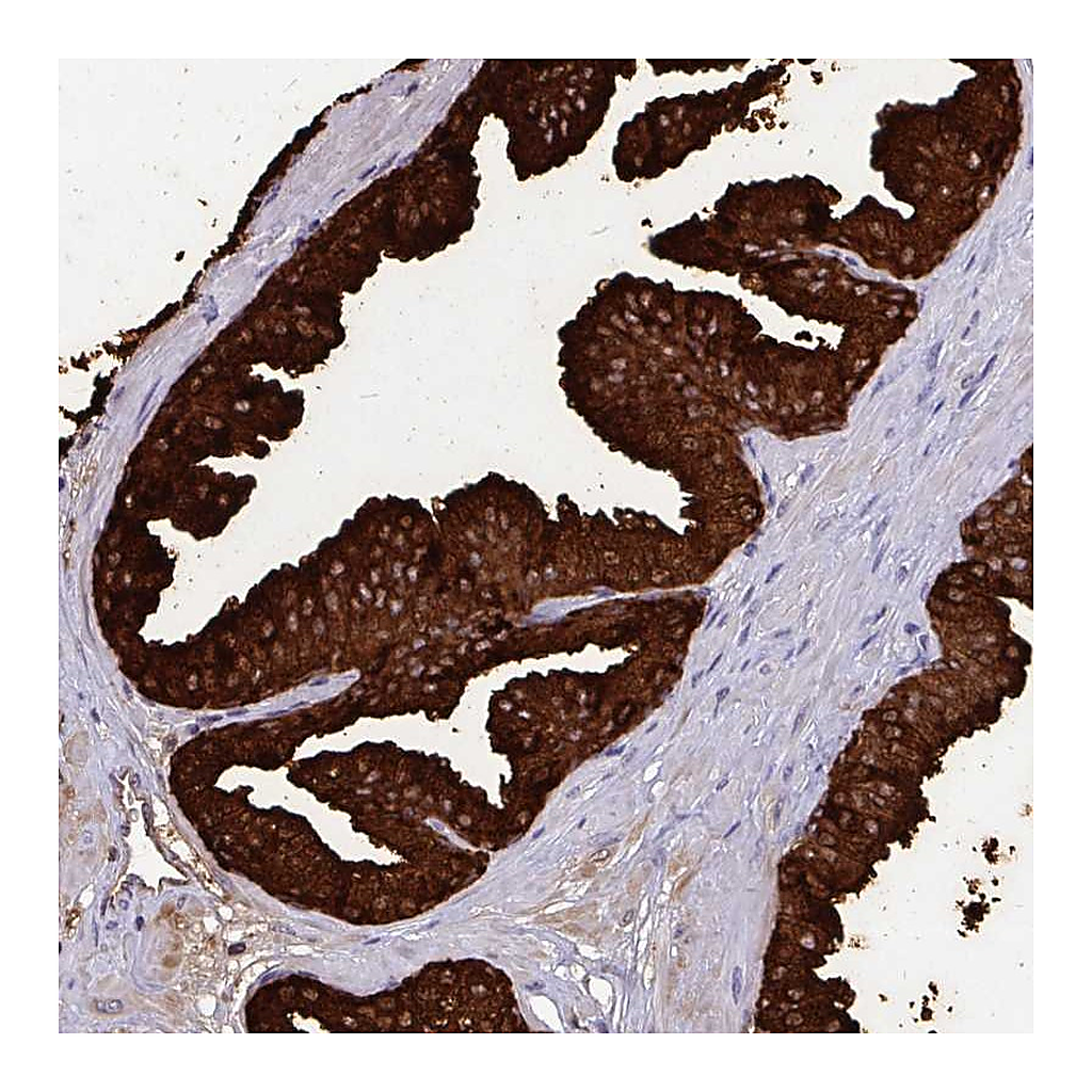 Atlas Antibodies Anti-OR10R2 Antibody