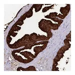 Atlas Antibodies Anti-OR10R2 Antibody
