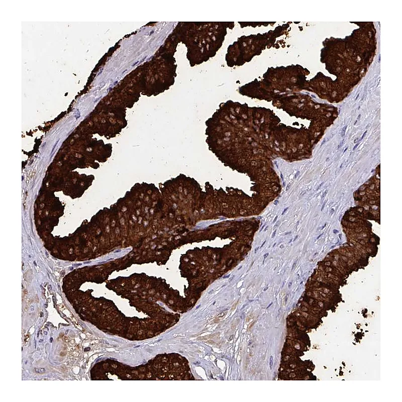 Atlas Antibodies Anti-OR10R2 Antibody