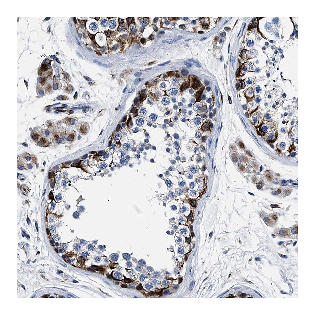 Atlas Antibodies Anti-OR10G3 Antibody