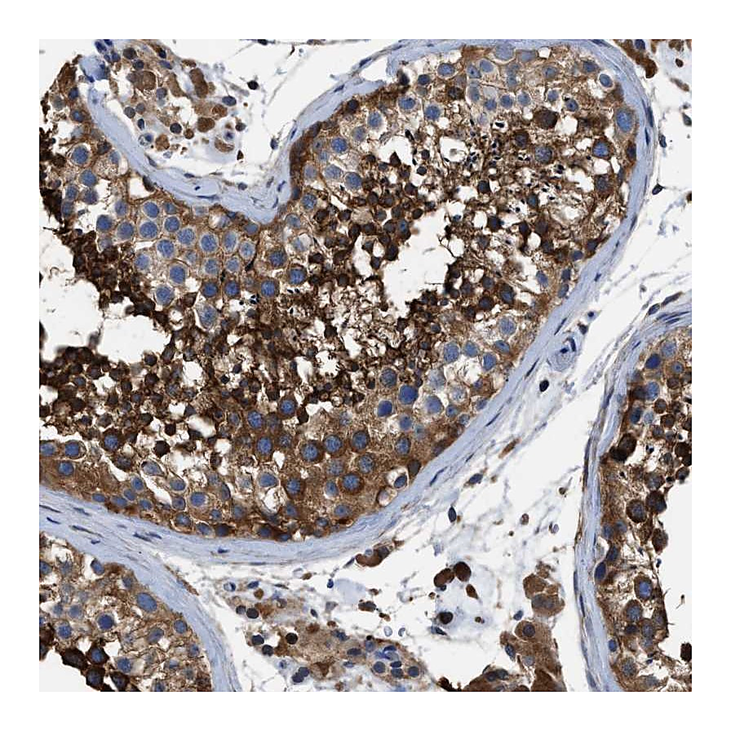 Atlas Antibodies Anti-OR10S1 Antibody