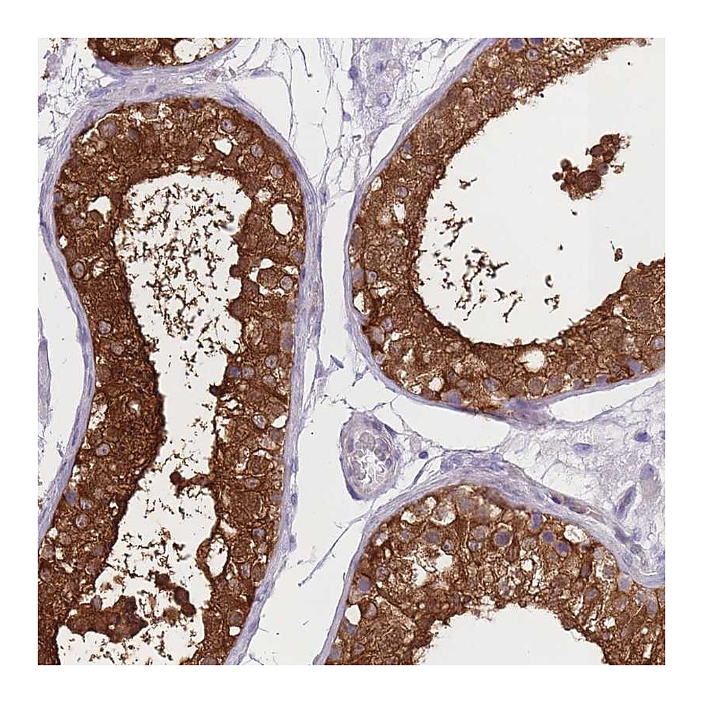 Atlas Antibodies Anti-OR11H1 Antibody