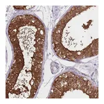 Atlas Antibodies Anti-OR11H1 Antibody