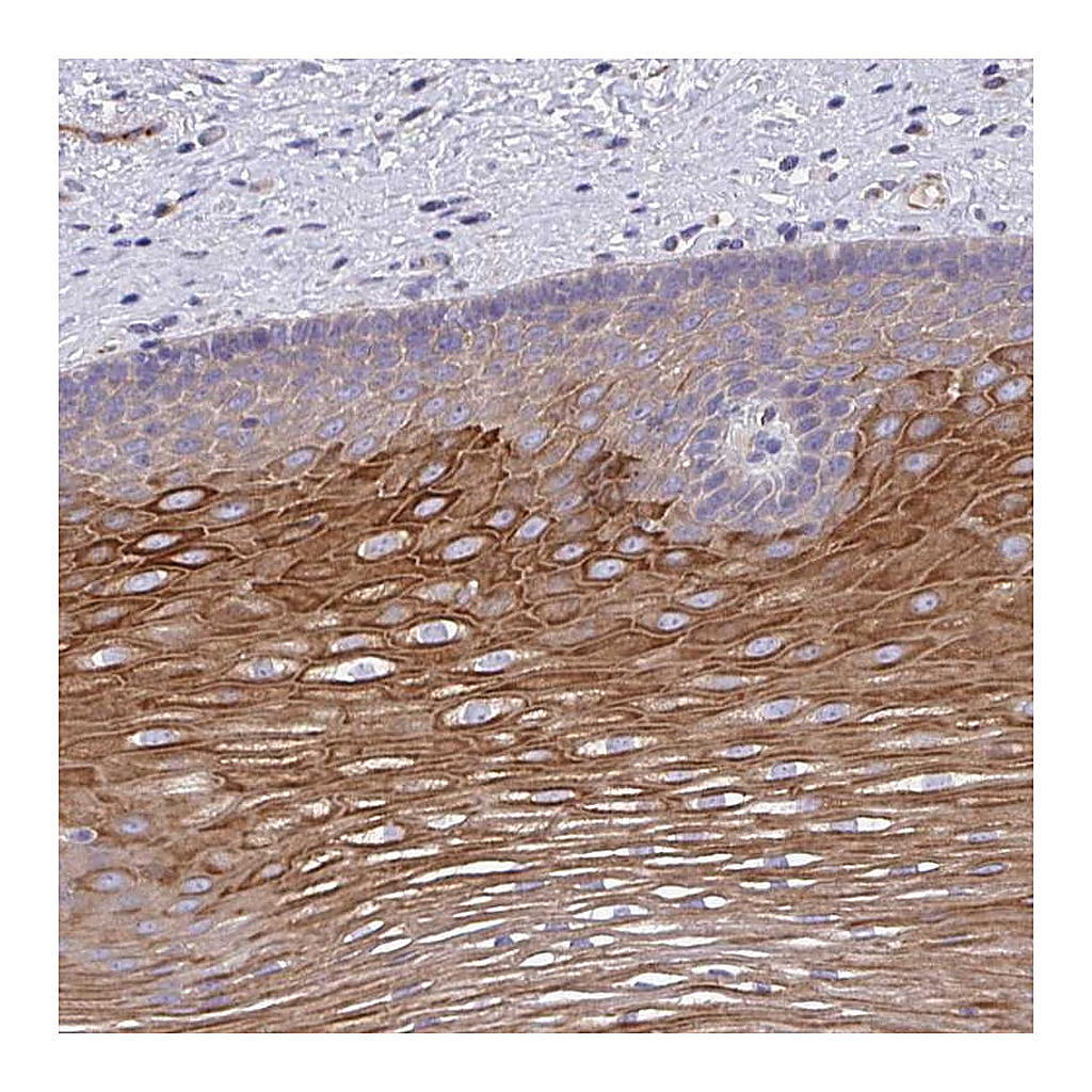 Atlas Antibodies Anti-OR10Z1 Antibody