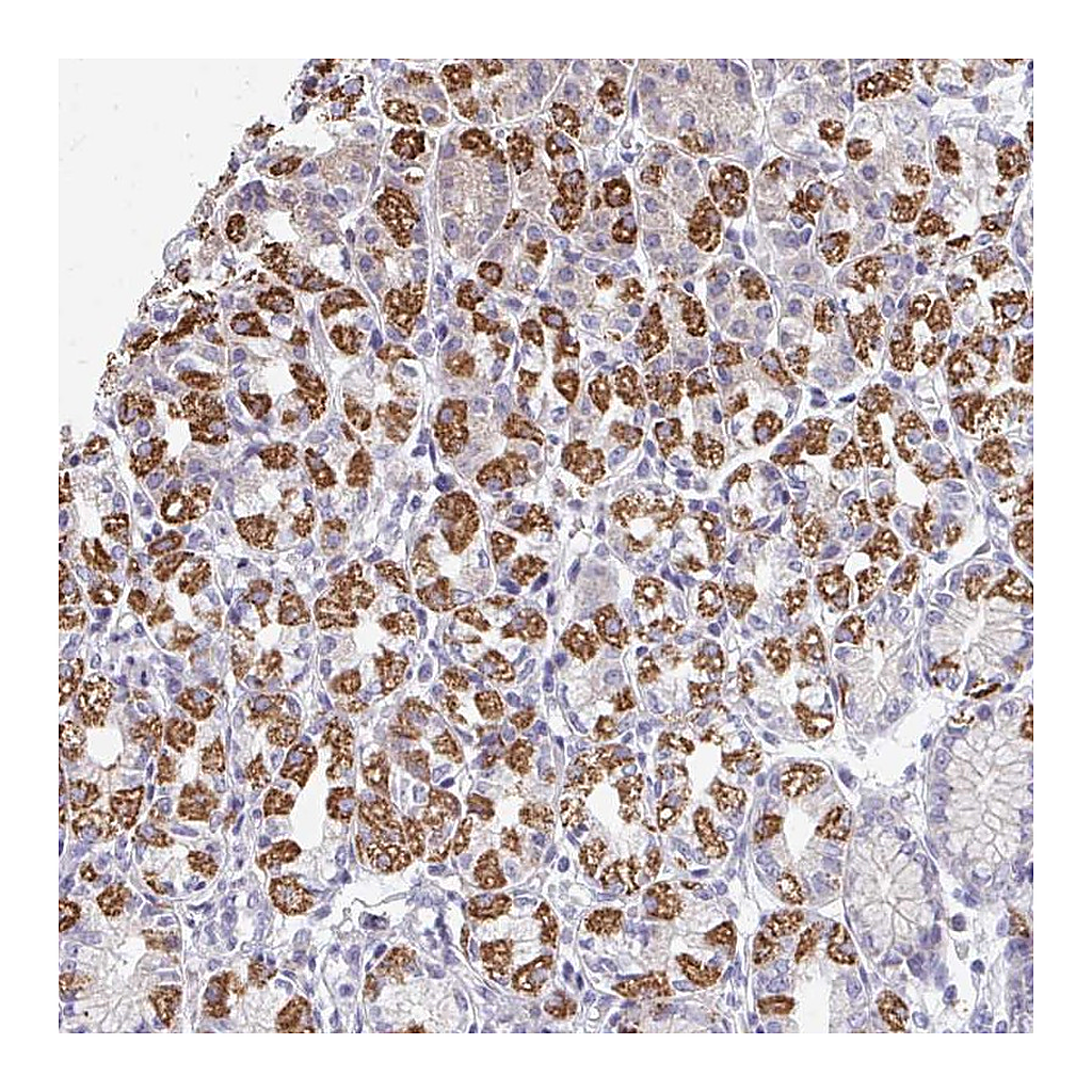 Atlas Antibodies Anti-OR10V1 Antibody