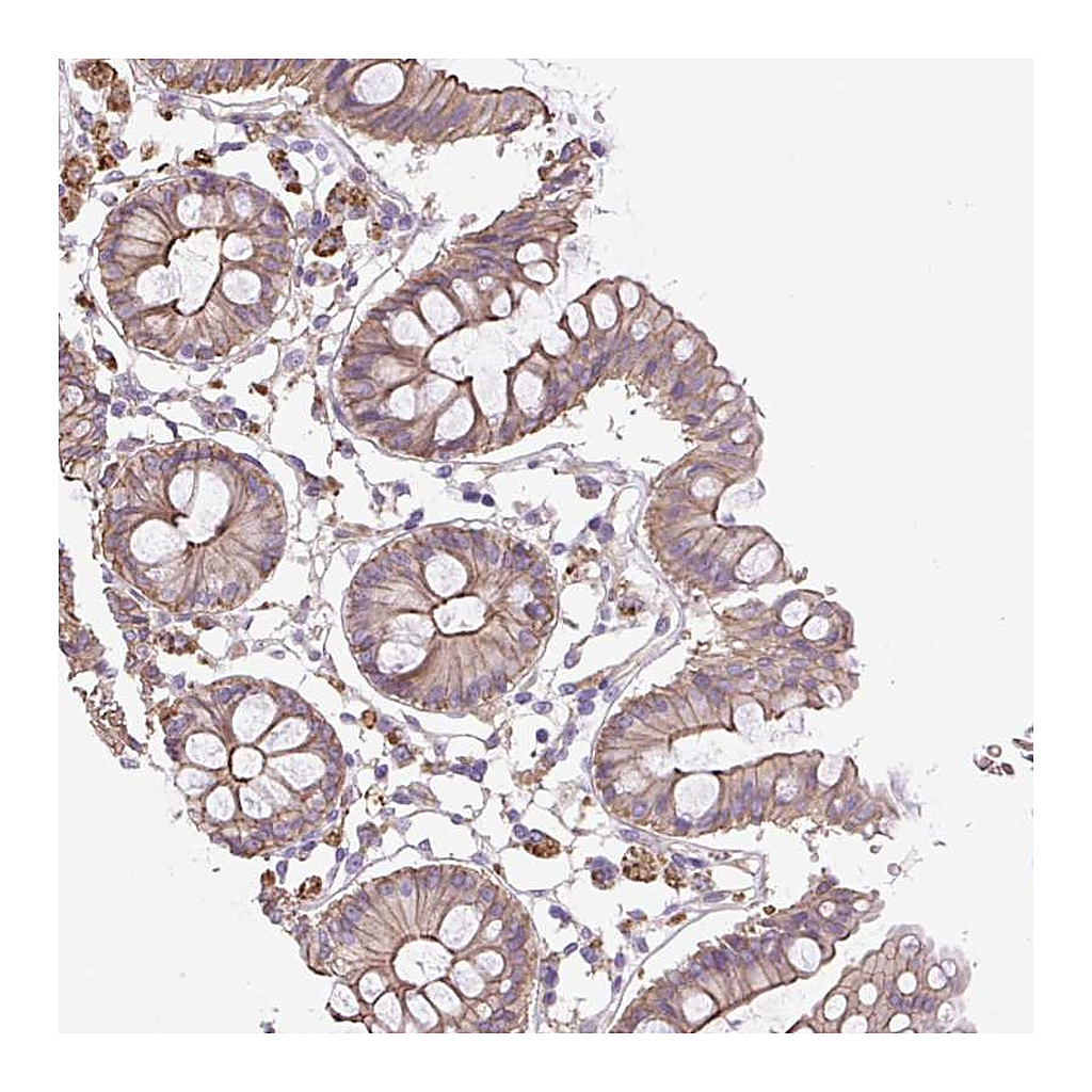 Atlas Antibodies Anti-OR13D1 Antibody