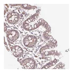 Atlas Antibodies Anti-OR13D1 Antibody