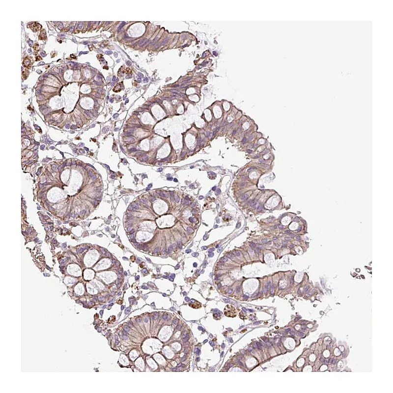 Atlas Antibodies Anti-OR13D1 Antibody