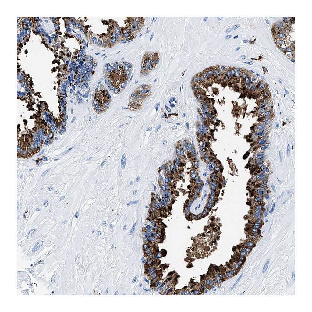 Atlas Antibodies Anti-OR14K1 Antibody