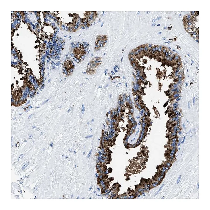 Atlas Antibodies Anti-OR14K1 Antibody