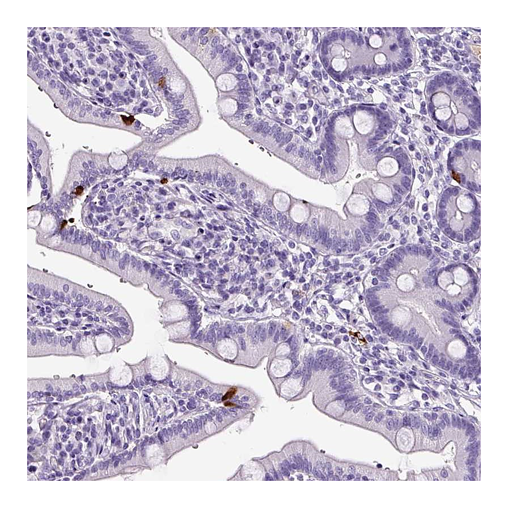 Atlas Antibodies Anti-OR14A2 Antibody