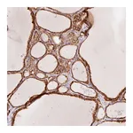 Atlas Antibodies Anti-OR13C3 Antibody