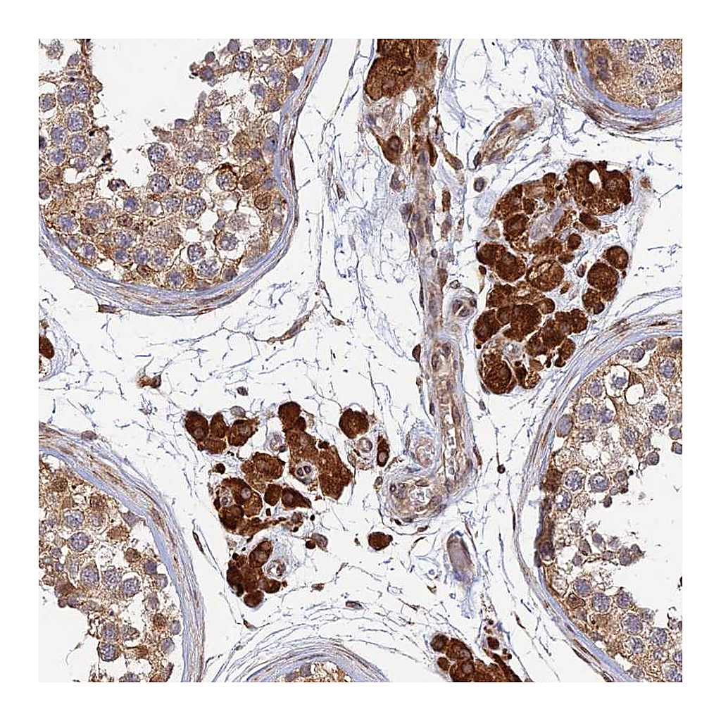 Atlas Antibodies Anti-OR14J1 Antibody