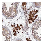 Atlas Antibodies Anti-OR14J1 Antibody