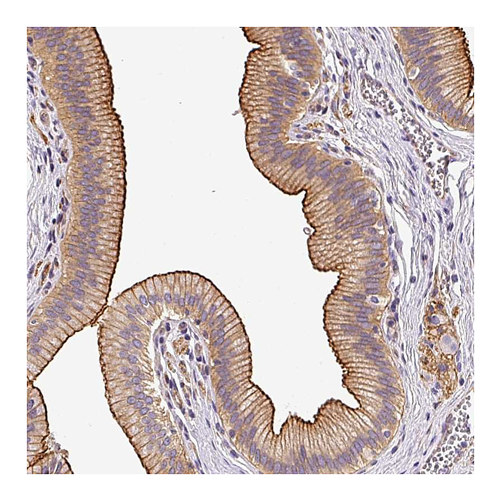 Atlas Antibodies Anti-OR11H4 Antibody