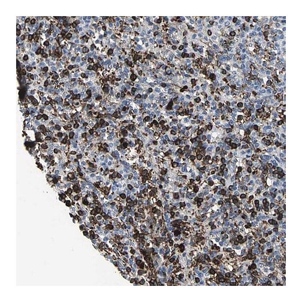 Merck Anti-GLI3 antibody produced in rabbit