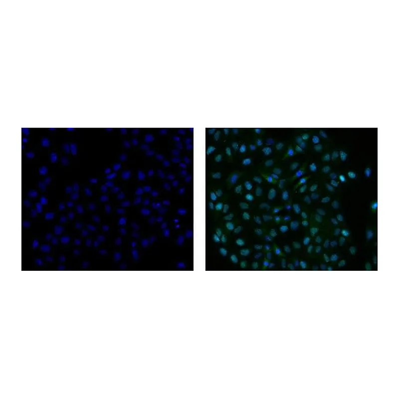 Thermo Fisher Scientific Rat anti-Mouse IgG2a Secondary Antibody, FITC, eBioscience