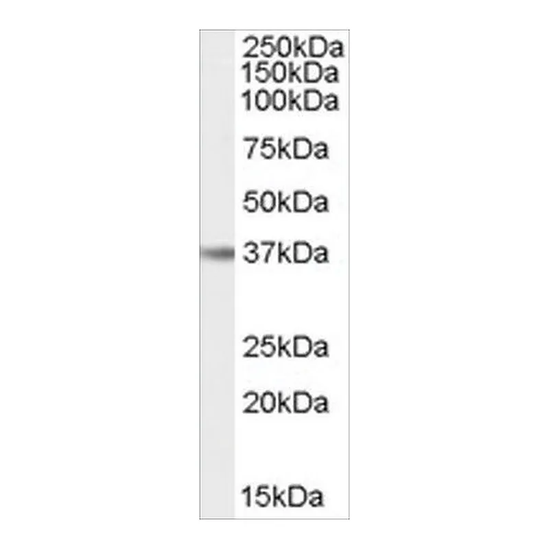Merck Anti-IL12B/IL12P40 (AB1) antibody produced in goat
