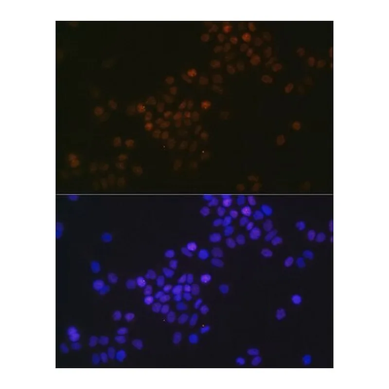 Merck Anti- c-Myc antibody produced in rabbit