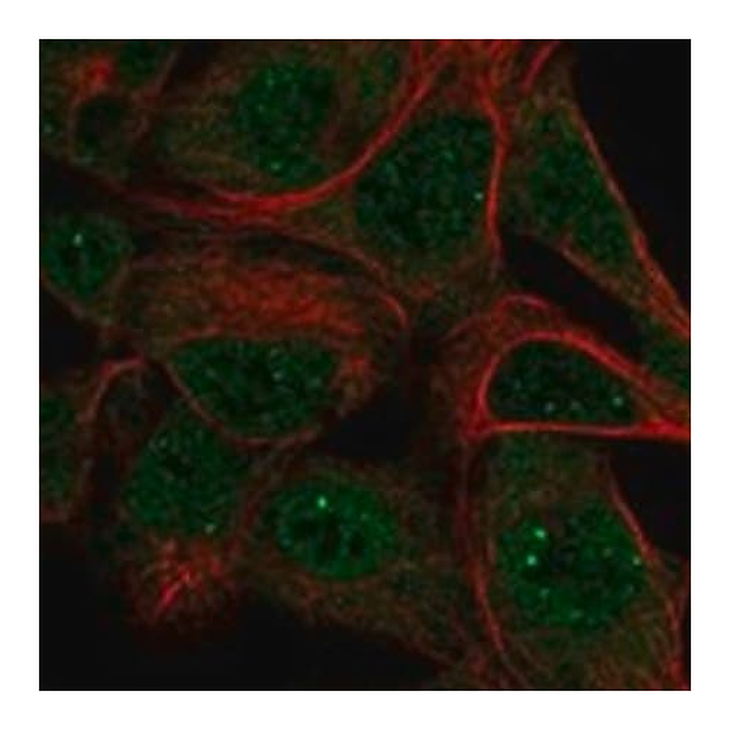 Merck Anti-SKIV2L antibody produced in rabbit