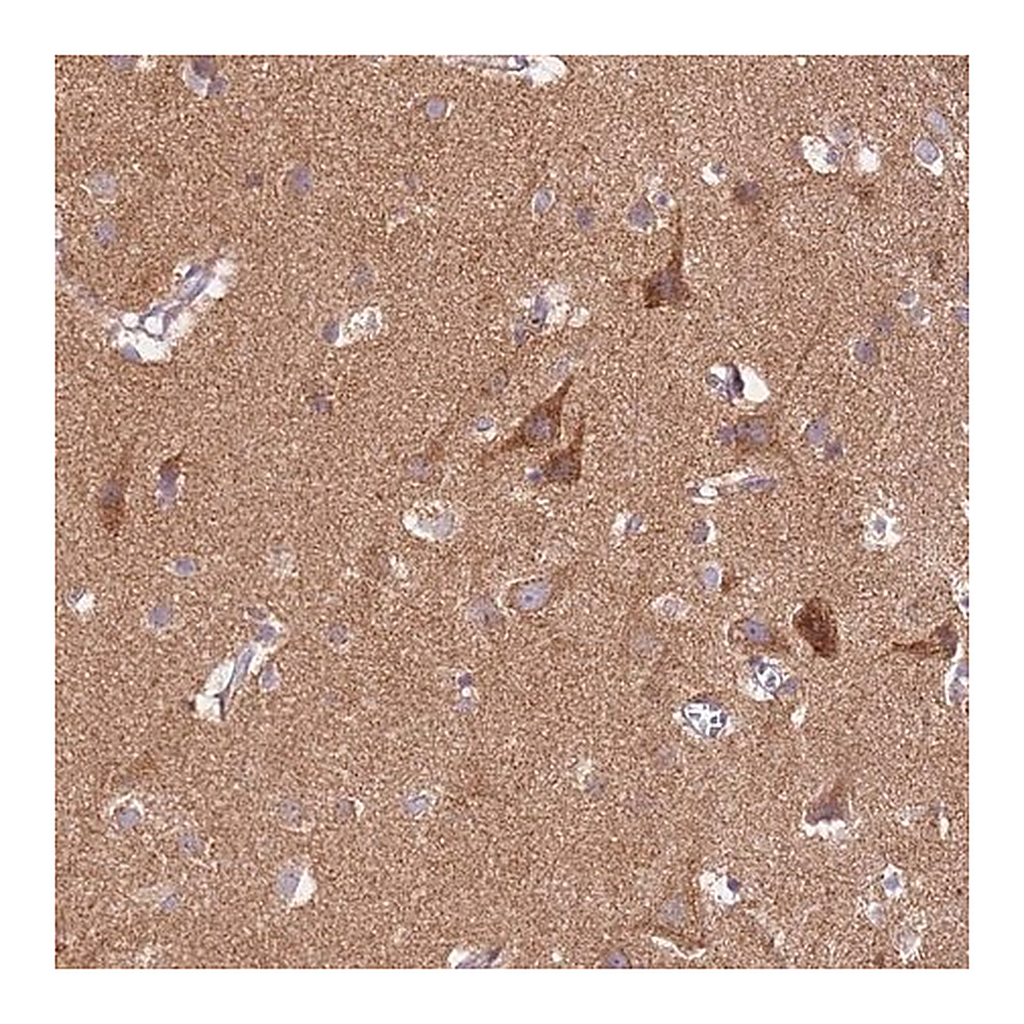 Merck Anti-PROKR2 antibody produced in rabbit