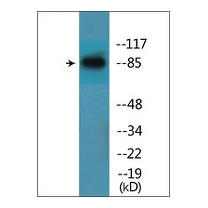 Merck ANTI-PHOSPHO-CATENIN-BETA (PTYR654)