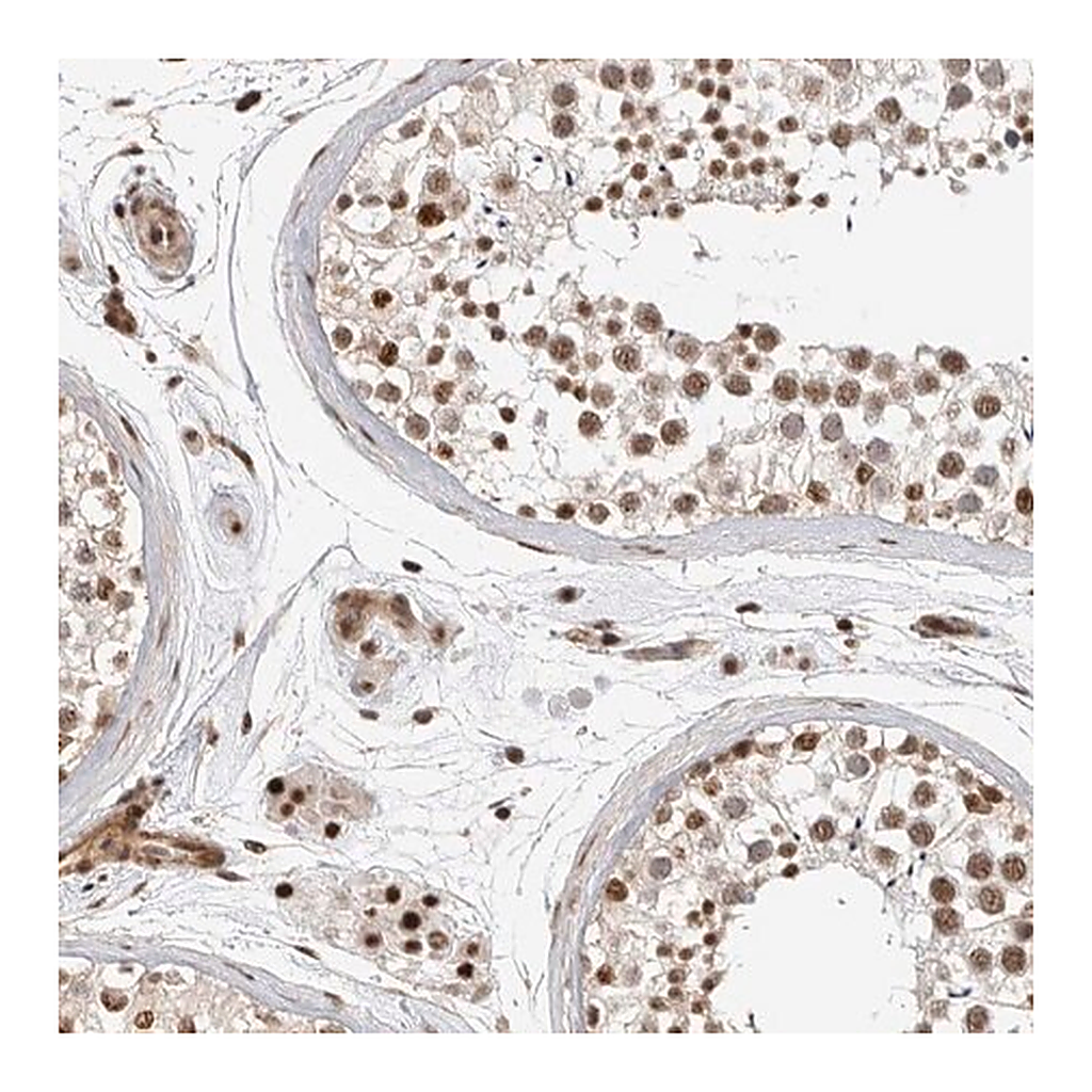 Merck Anti-GPATCH2 antibody produced in rabbit
