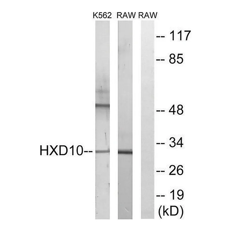 Merck Anti-HOXD10 antibody produced in rabbit