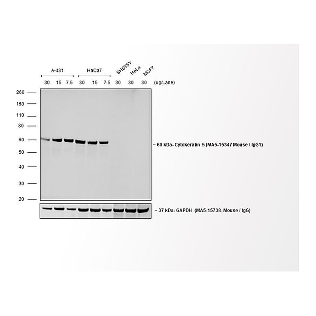 Thermo Fisher Scientific Goat anti-Mouse IgG1 Cross-Adsorbed Secondary Antibody, Biotin-XX