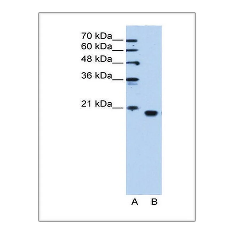 Merck Anti-PEBP1 antibody produced in rabbit