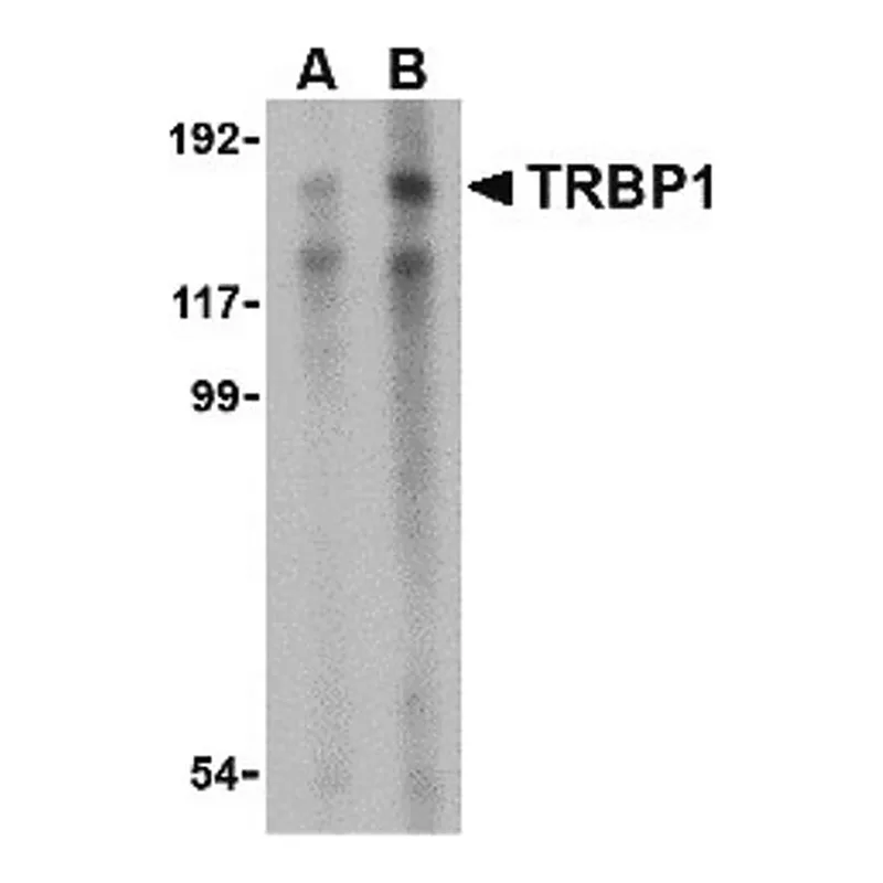 Merck Anti-TRBP1 antibody produced in rabbit
