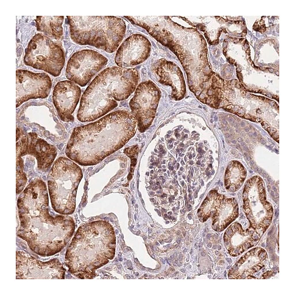Merck Anti-SLC16A4 antibody produced in rabbit