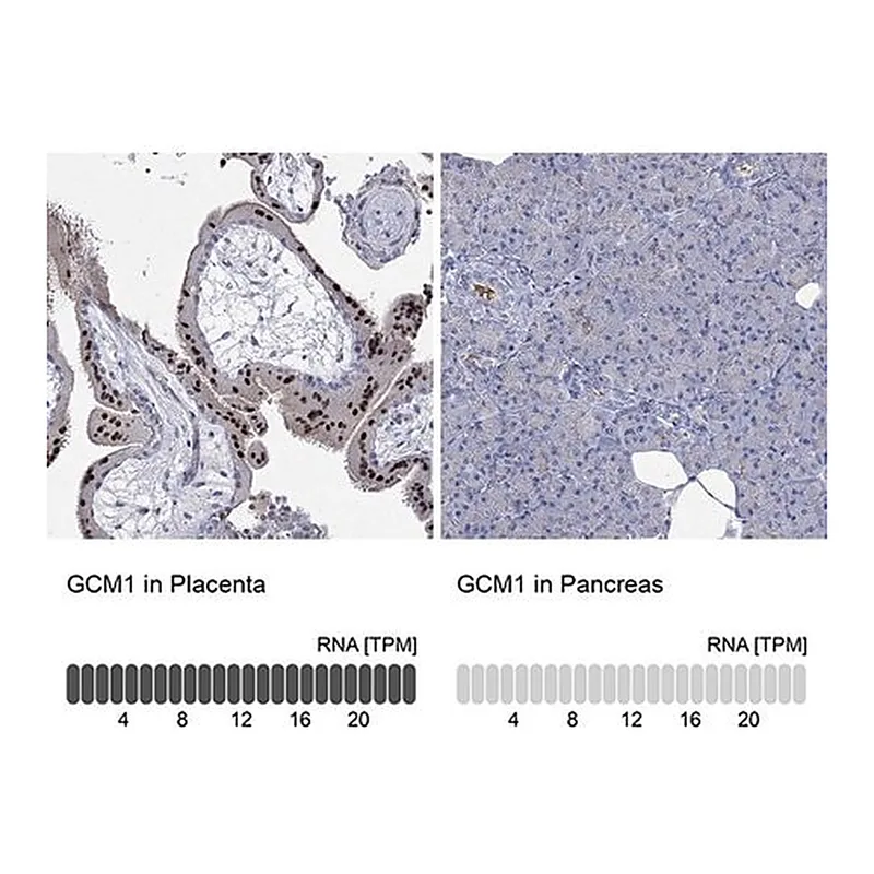 Merck Anti-GCM1 antibody produced in rabbit
