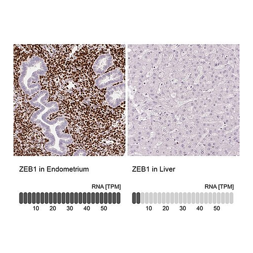 Merck Monoclonal Anti-ZEB1 antibody produced in mouse
