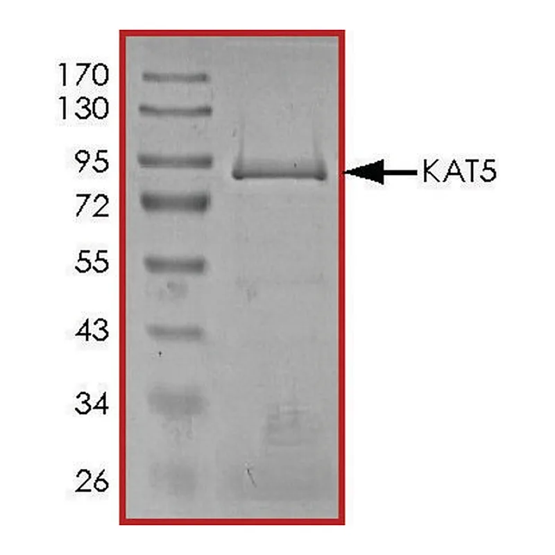 Merck KAT5 (TIP60), Active