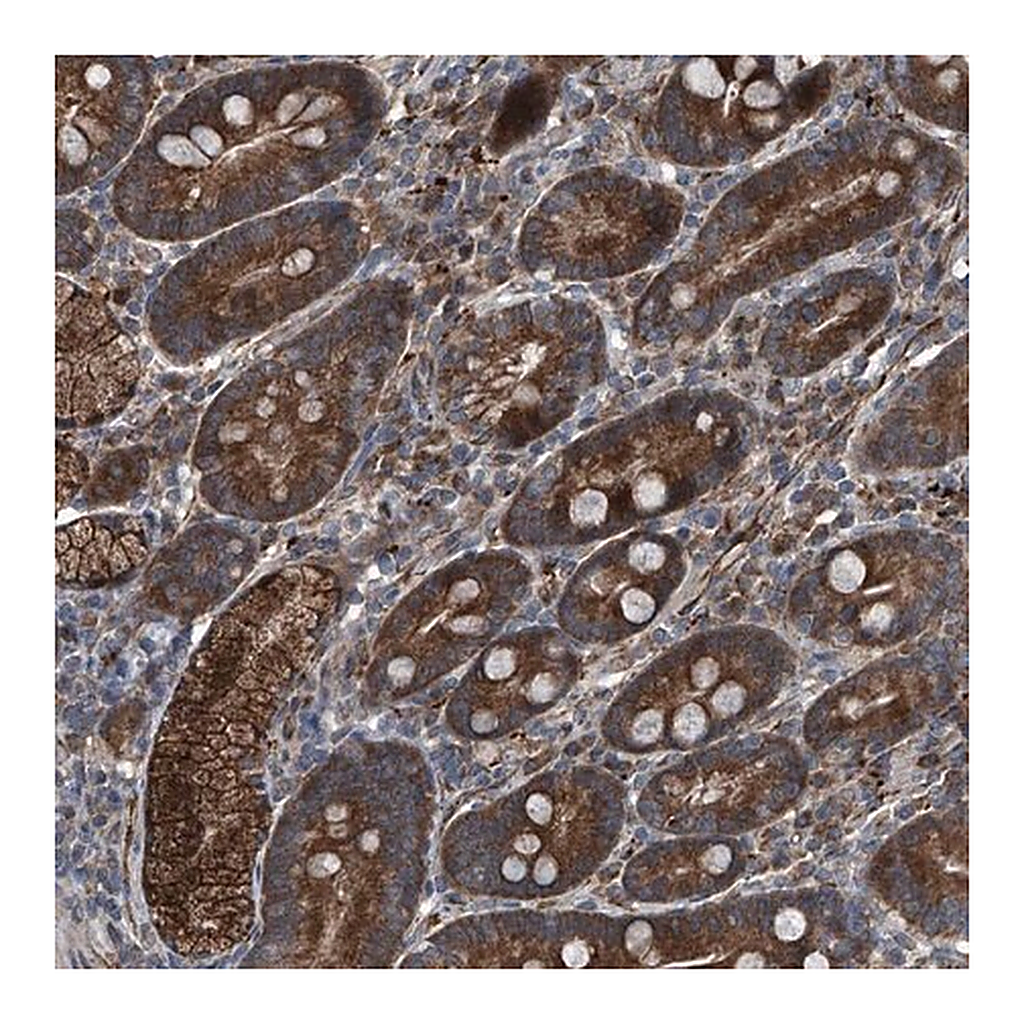 Merck Anti-SENP2 antibody produced in rabbit