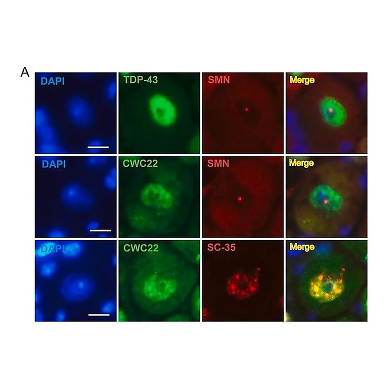 Merck Anti-CWC22 antibody produced in rabbit