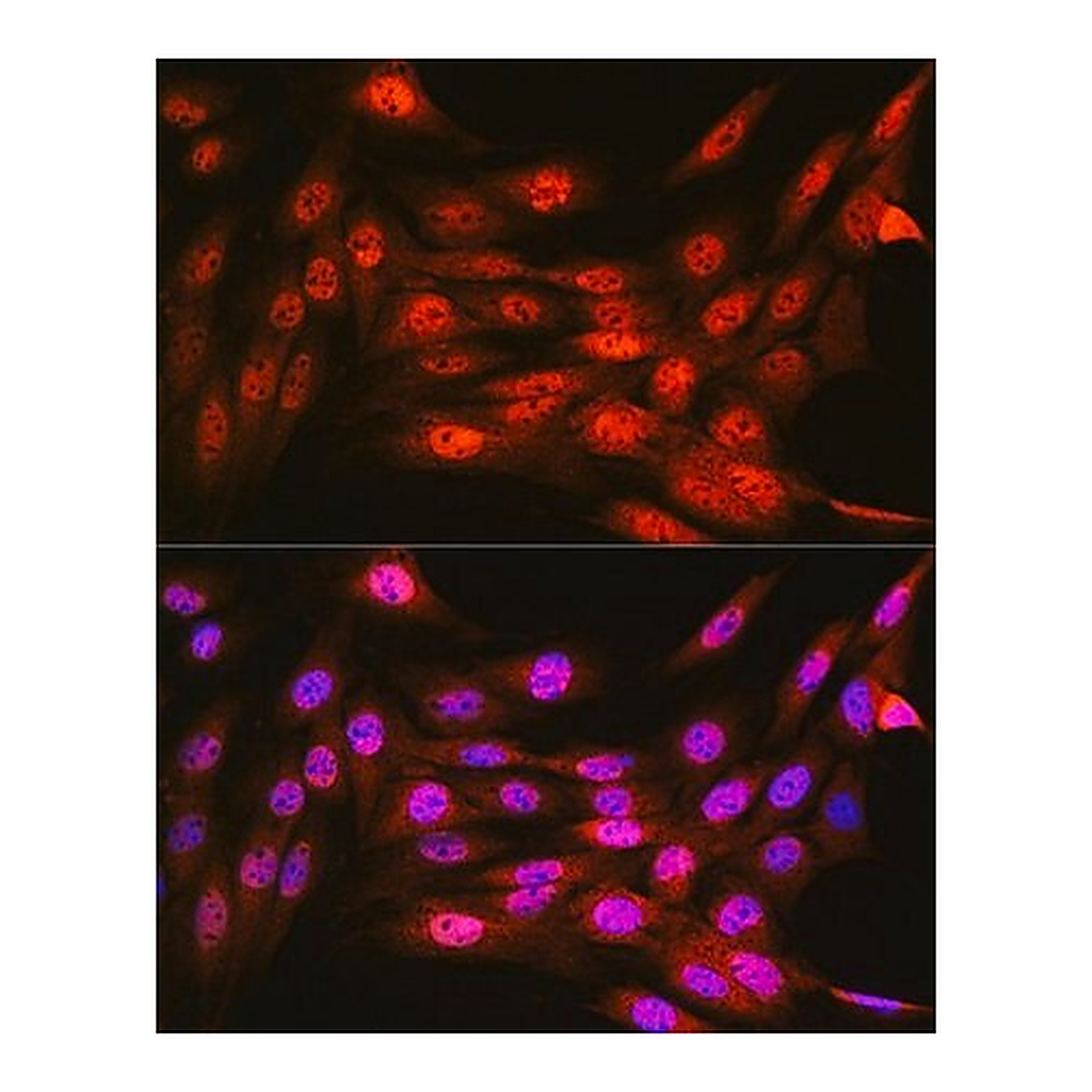Merck Anti-VCP antibody produced in rabbit