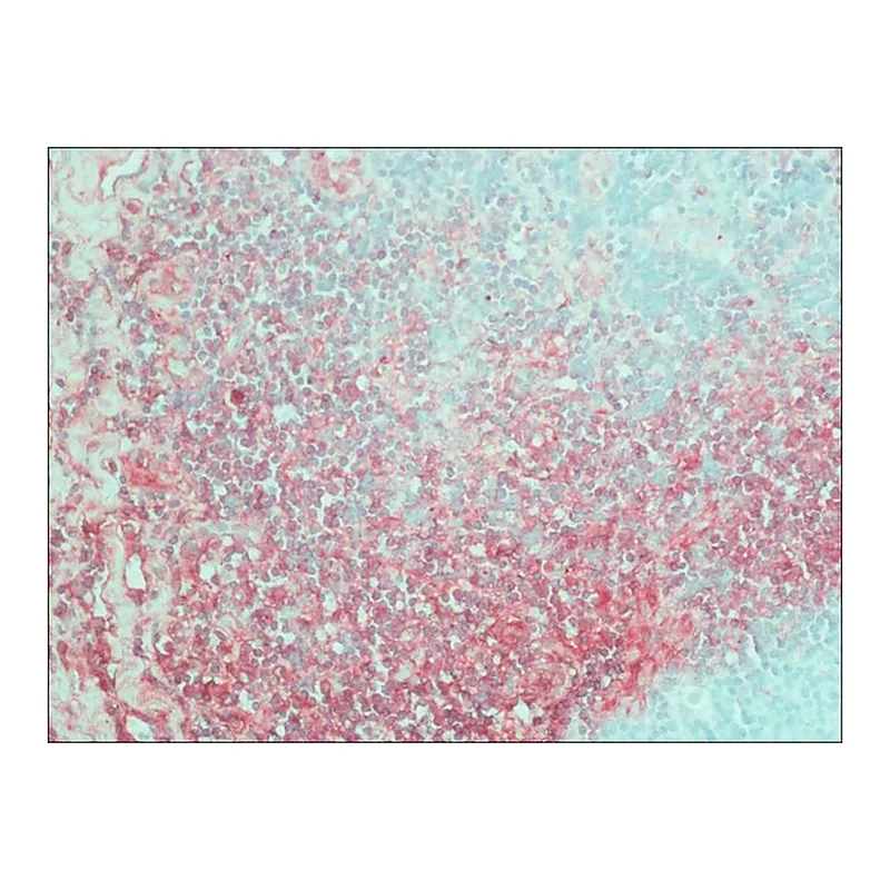 Merck Anti-Human IgM (mu-chain specific)-Alkaline Phosphatase antibody produced in goat