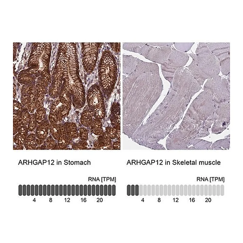 Merck Anti-ARHGAP12 antibody produced in rabbit