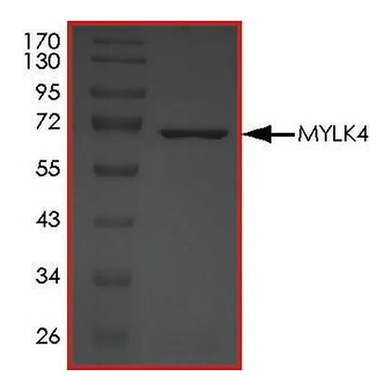Merck MYLK4, ACTIVE