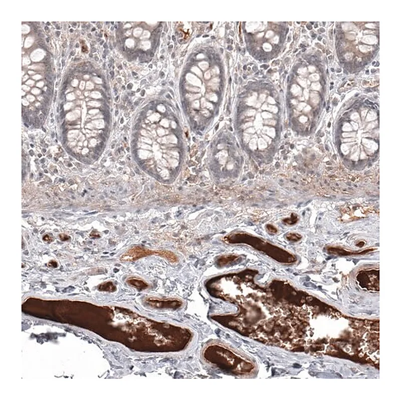 Merck Monoclonal Anti-SAA1 antibody produced in mouse