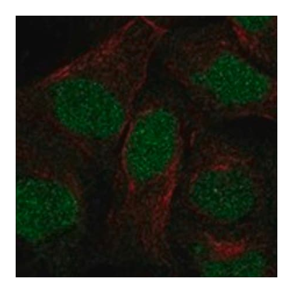 Merck Anti-ANKRD20A3P antibody produced in rabbit