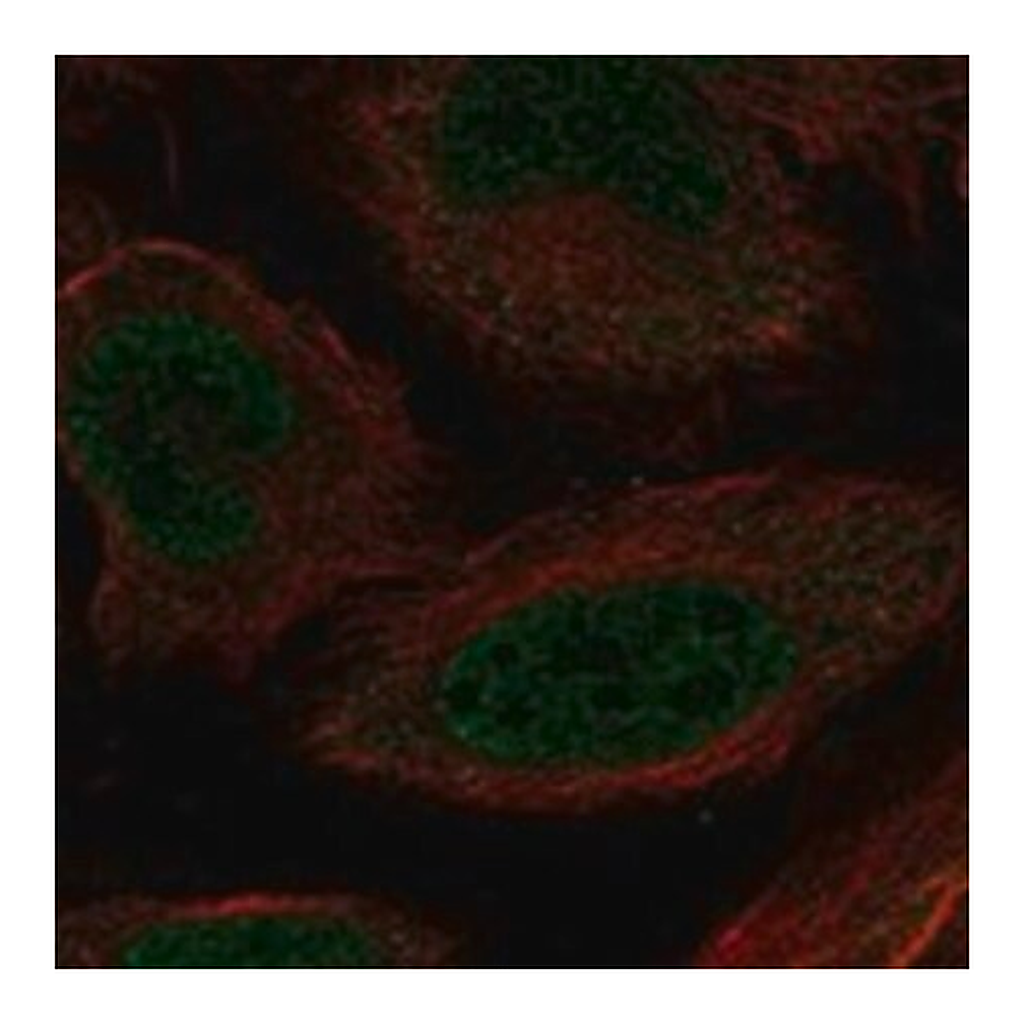 Merck Anti-MEOX1 antibody produced in rabbit