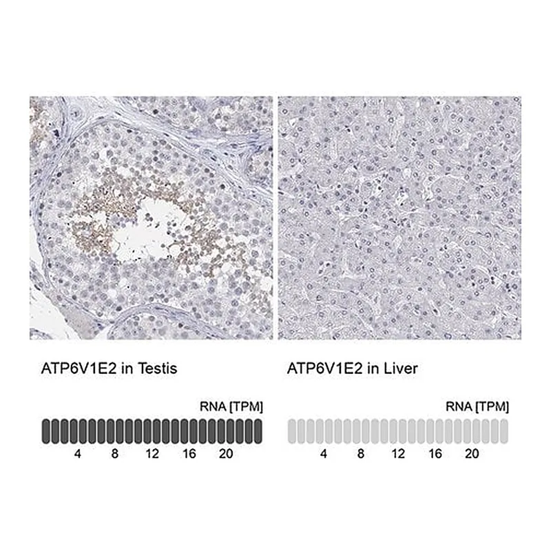 Merck Anti-ATP6V1E2 antibody produced in rabbit