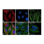 Thermo Fisher Scientific Goat anti-Rabbit IgG (H+L) Secondary Antibody, DyLight 633