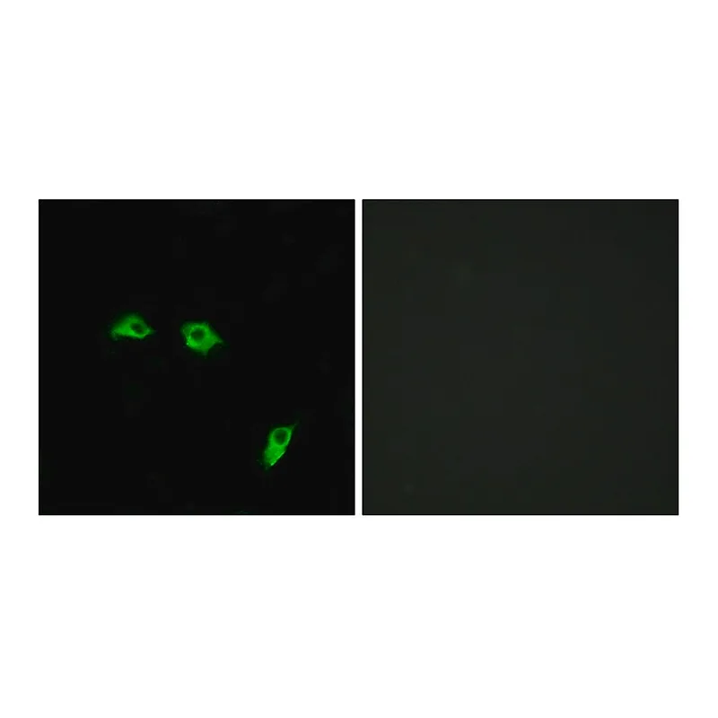 Merck Anti-GABBR1 antibody produced in rabbit