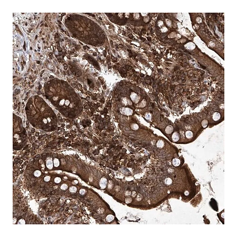 Merck Anti-MAGED2 antibody produced in rabbit