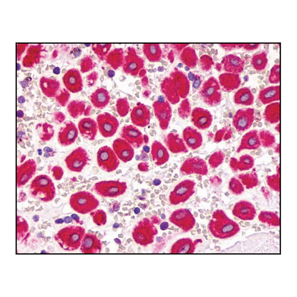 Merck Anti-CXCR2 antibody produced in rabbit