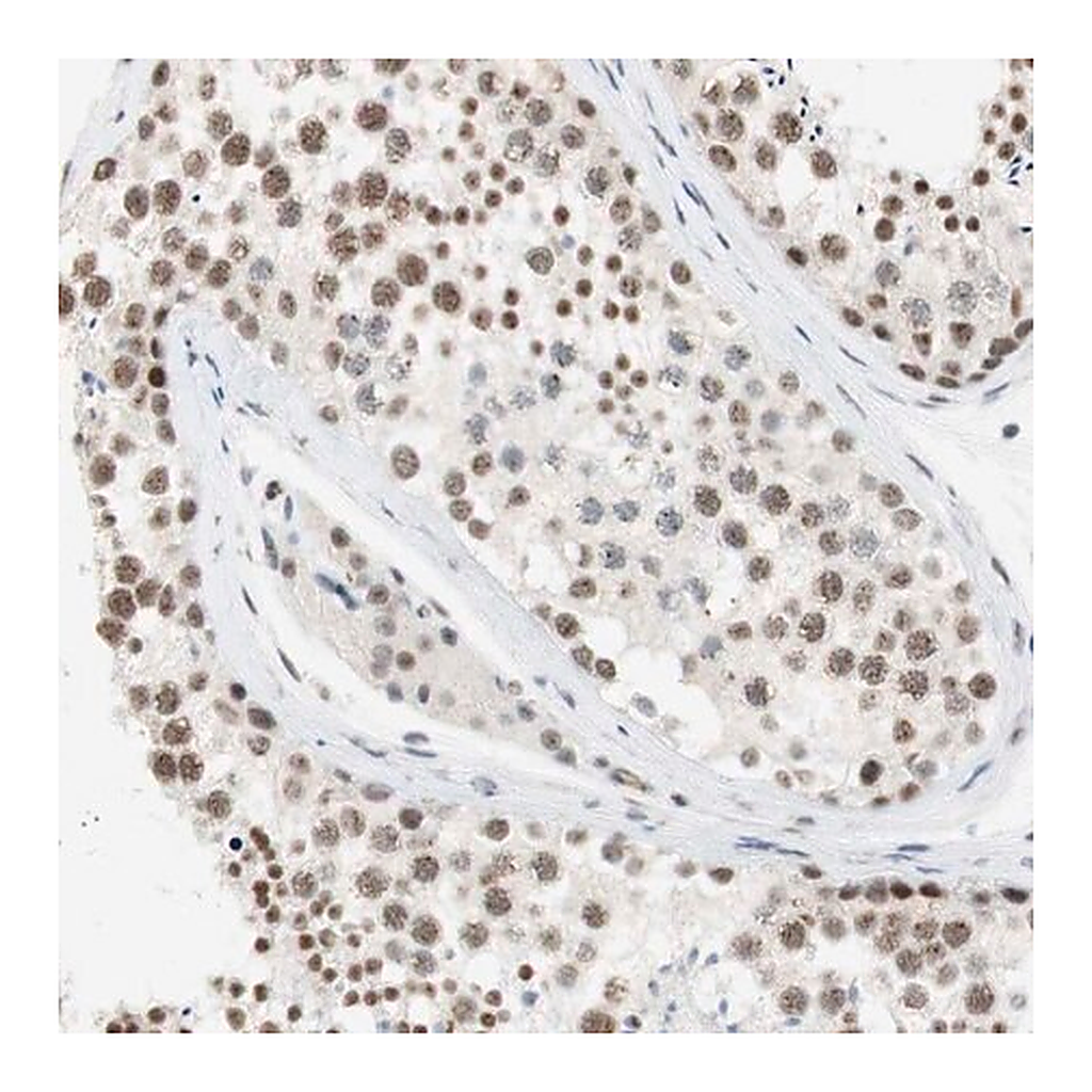 Merck Anti-SAP18 antibody produced in rabbit